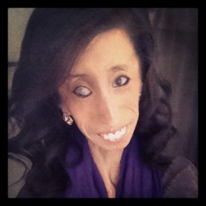 Most Beautiful Girl in the World – Lizzie Velasquez